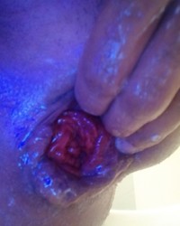 photo-thumb